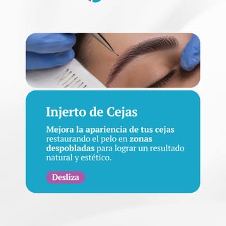 ✨ Recupera unas cejas más densas y naturales.

El injerto de cejas es una excelente opción para quie