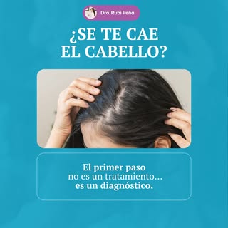 La caída del cabello puede tener diferentes causas, por eso es importante siempre realizar una evalu