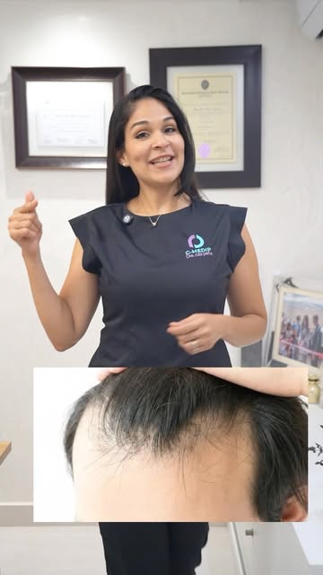 ¿Pérdida de cabello? No todas las alopecias son iguales… y tampoco se tratan de la misma manera. 👀
