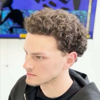 Zwischenergebnis nach der Haartransplantation in Köln ✨

Die Haartransplantation wurde am 05.10.2025