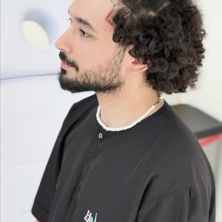 Professionelle Haartransplantation – ohne komplette Rasur. ✨

Mit unserer Unshaven-FUE-Methode kann 