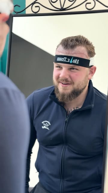 Gemeinsam mit David haben wir seine neue Haarlinie geplant. Dabei war uns besonders wichtig, dass si