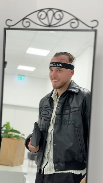 Bei Dominik ging es nicht einfach darum, kahle Bereiche aufzufüllen. Unser Ziel war es, eine Haarlin