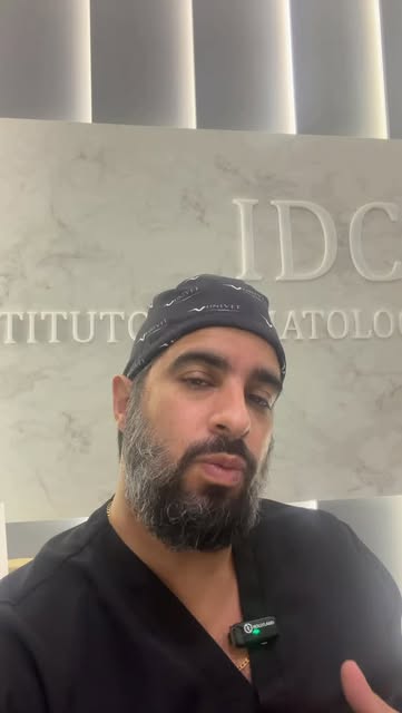 Esse paciente já havia passado por uma cirurgia híbrida, FUT + FUE. Mas o resultado ficou artificial