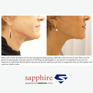 Heard about our skin tightening treatments? Sapphire Clinic offers various skin tightening treatment