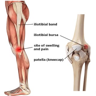 Effective Treatment for IT Band Friction/Pain Syndrome 
👇🏼
https://www.dynamicregenmedicine.co.uk/