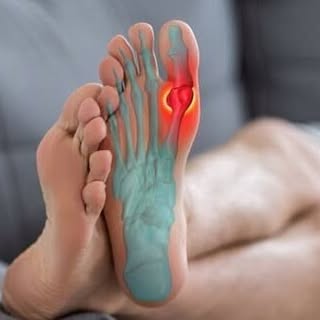Big Toe Pain & Osteoarthritis
-
Pain or stiffness in the big toe can make walking, running, and trai