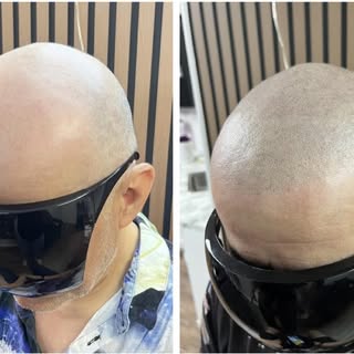 From a blank canvas to a natural, realistic look 🔥

SMP is all about creating the illusion of a cle