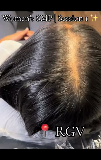 Thinning hair? 👀 You don’t have to live with a visible scalp.

This is only SESSION 1 of Women’s SM