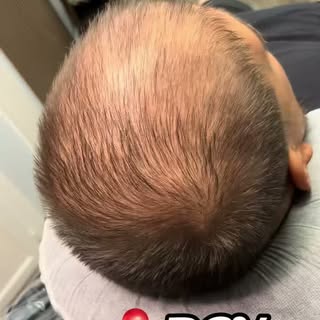 Two months since his last session + a shorter haircut meant we had some density to rebuild. 👏🏼

Ha