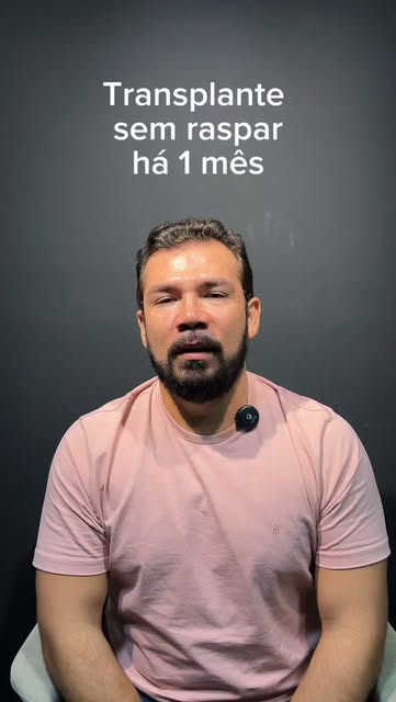 “Vou ter que raspar todo o cabelo?”

Essa é uma das primeiras preocupações de quem pensa em fazer um