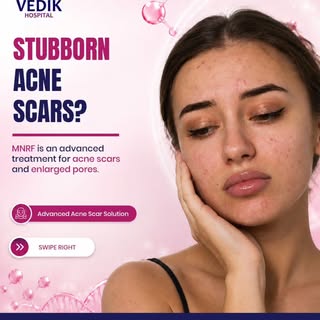 👉👉👉Acne scars aur enlarged pores se pareshan hain?

Ab paaye  smoother, healthier aur more confid