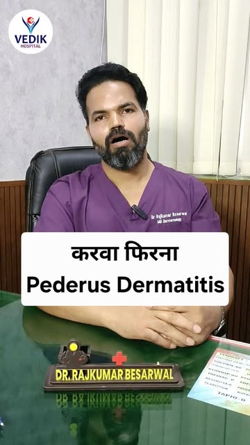 करवा/ तिलण फिरना Pederus Dermatitis🤗