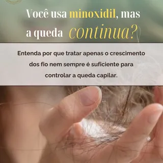 Você usa minoxidil, mas a queda continua? 💧

O minoxidil é um dos tratamentos mais conhecidos para 
