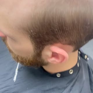 Men’s Hair Replacement  call us for more information! 
#positivehair