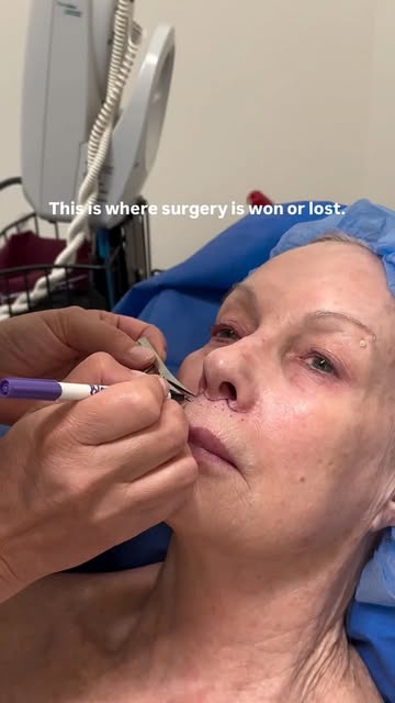 People think surgery starts with the incision. It starts here.

Before anything is cut, every line g