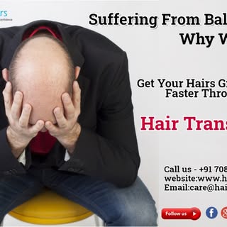 Suffering From Baldness???
Why Worry?
Get Your hairs Grow Back Faster Through Hair Transplant.
➥Get 