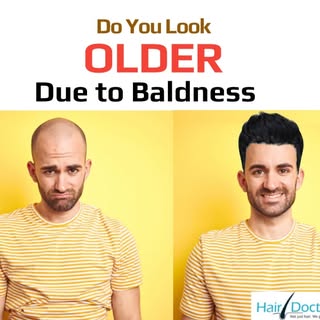 Do You Look Older Due To Baldness Get FUE Hair Transplant and Get Your Younger Look Back.

Get Free 