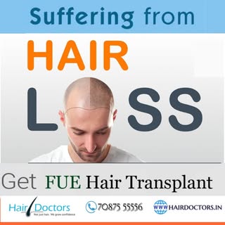 Suffering From Hair Loss Get FUE Hair Transplant.
0% Easy EMI Available
Consult Your Dermatologist T