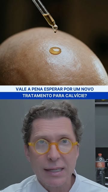 Esperar ou agir?

Vale a pena esperar por um novo tratamento para a calvície?

Essa é uma das pe