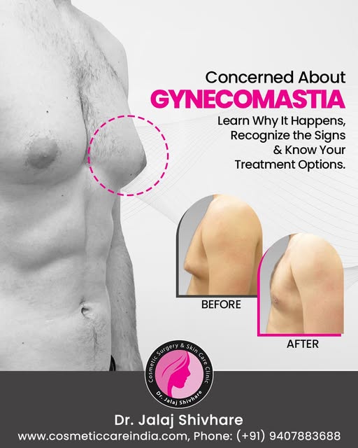**Gynaecomastia: When male breast enlargement affects your confidence.**

Gynaecomastia is a common 