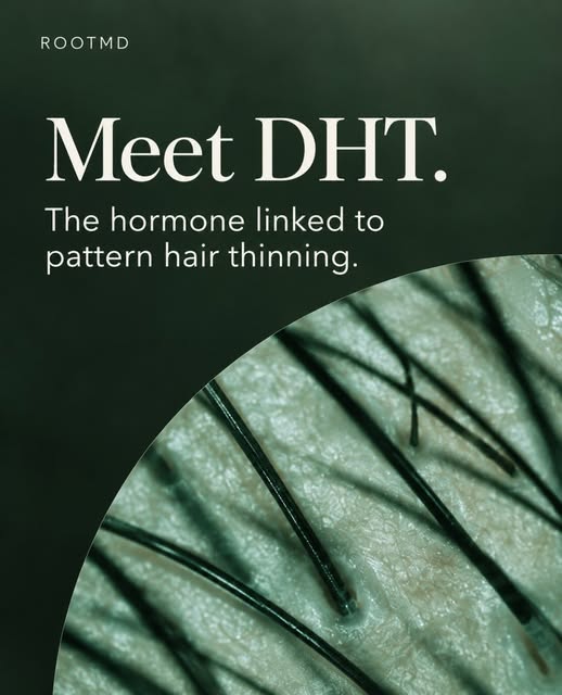 DHT and Hair Loss: What You Need to Know 🧬

DHT is one hormone linked to pattern hair loss in both 