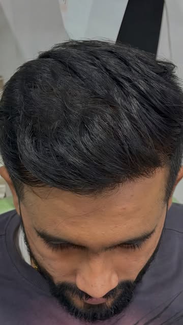 Sir, I want my hairline like it was in 2019…” ❤️

A simple wish.
A clear goal.
And a transformation 