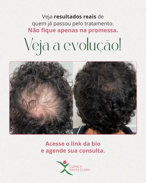 Aqui, você vê a evolução de um caso real e entende por que cada tratamento precisa ser acompanhado d