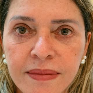 Rejuvenescer não significa mudar quem você é.

Significa recuperar os contornos que o tempo suavizou