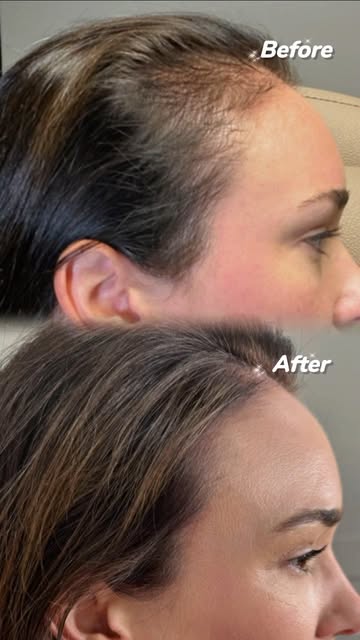 Some transformations are better shown than described. 

This is what consistent FoLix treatment can 