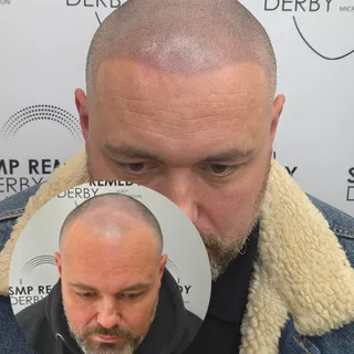 Another happy client. 3 sessions complete! 🤝

A clean, slightly receded hairline that shapes the fa