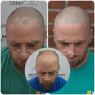 Fresh SMP transformation 🔥

A sharp hairline isn't for everyone... but when it suits the face, it c