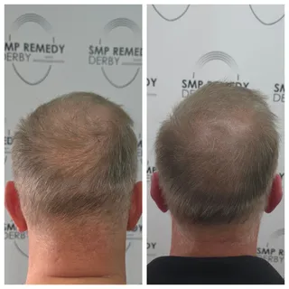 A subtle density boost through the crown 👍🏼
The goal wasn't to completely change the look, but to 