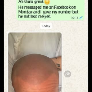 Receiving messages like this out of the blue always makes my day.

This client had his treatment ove