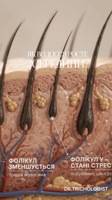 Що насправді відбувається з волоссям після нанесення лосьйону? 🤔

Щоб це зрозуміти, спочатку варто 