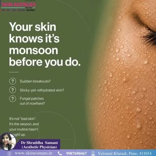 Monsoon skincare should focus on keeping the skin clean, light, and protected because humidity incre