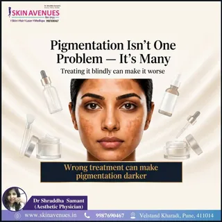 Pigmentation means darkening of the skin due to increased or uneven melanin production.
Common cause