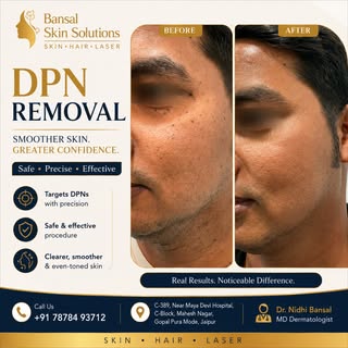 ✨ Confidence begins with clear, healthy skin. ✨

Say goodbye to unwanted DPNs (Dermatosis Papulosa N