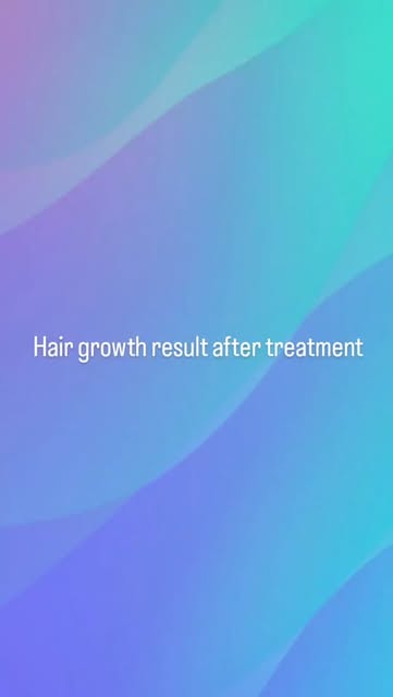 PRP – using your own platelet-rich plasma
✨ Exosome Therapy – advanced regenerative support
✨ PDRN –