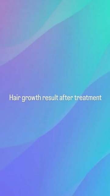 Enjoy smoother skin with professional laser hair removal treatments for women and men.
✔ Long-lastin