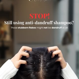 Not every flaky scalp is dandruff. 

Persistent flakes, itching, and thick scales can be signs of sc