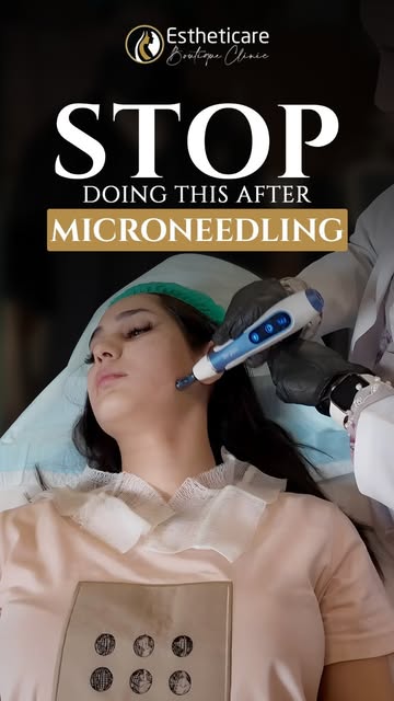 Microneedling done? Don’t make these aftercare mistakes. 🚨

Your skin needs time to heal, avoid the