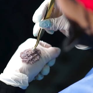 🙌🏻🤩Todos nuestros pacientes han obtenido resultados satisfactorios y reales.

💉Nos esmeramos dem