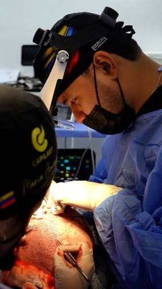 Recién salido de su #InjertoCapilar y con una experiencia que superó sus expectativas.

Sin dolor, a