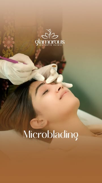 Ever wondered how perfect brows are created? Watch our skilled doctor in action, crafting the perfec