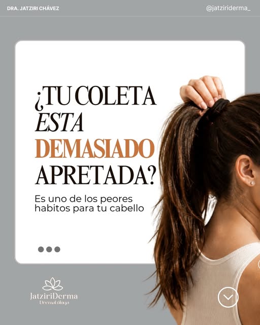 ✨ ¿Sueles llevar el cabello en una coleta muy apretada? Ojo con este hábito.

La tensión constante s