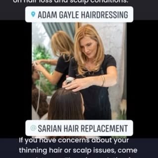 #hairloss #thinninghair #menopause