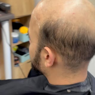#hair_system_men #hairsystem #hairtransformation #beforeandafter #toupee #hairunit #manweave #hairlo