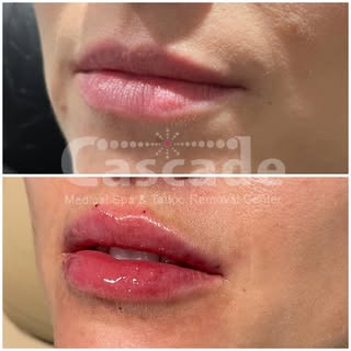 Curated with little amounts over 3 visits! Achieving a natural result is Amanda’s specialty. 💋