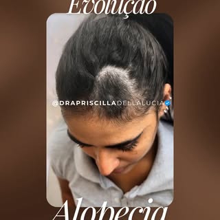 Existem resultados que não são apenas clínicos — são emocionais.
Quando essa paciente chegou até mim